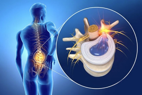 保护腰椎,正确的坐姿与环境:是打造坚固的外部防线